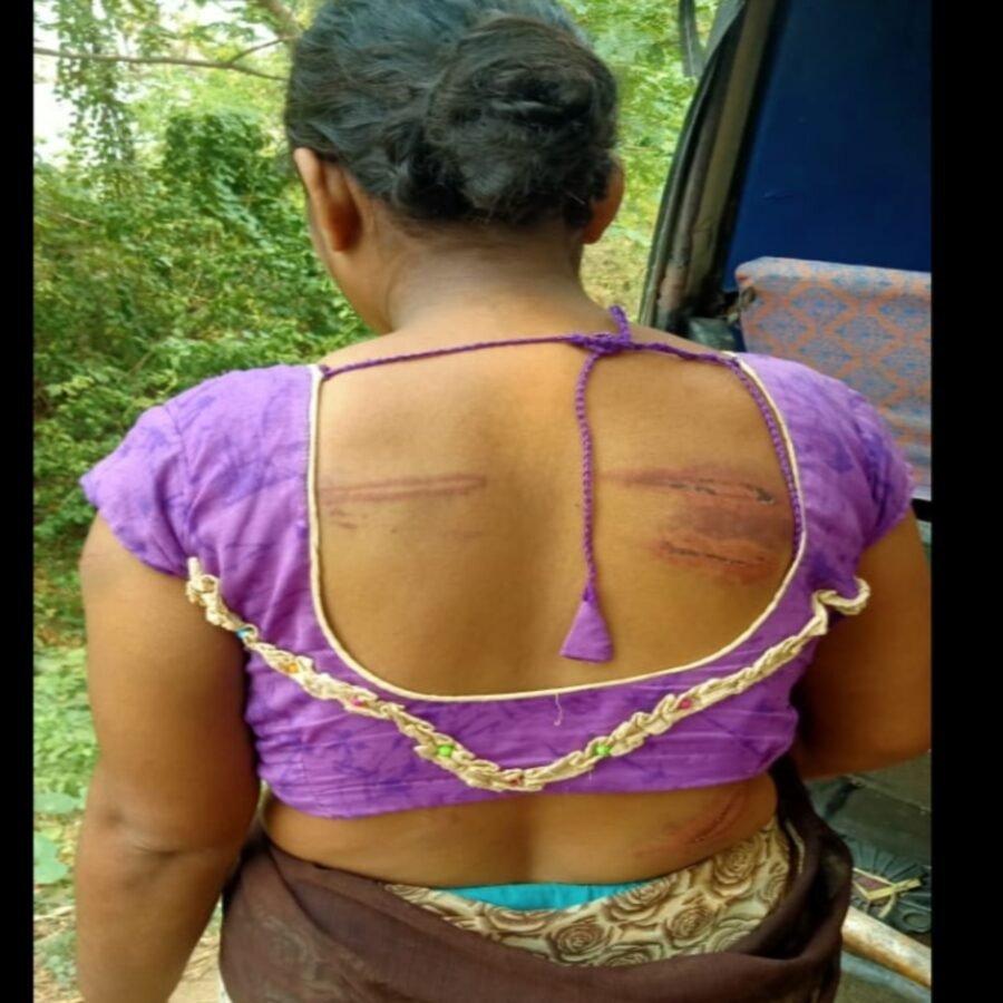 रोहतास: पत्नी को बेरहमी से पिटाई मामले में 9 लोगों पर प्राथमिकी, मीडिया दर्शन में छपी खबर का असर| पीड़ित महिला ने पुलिस पर लगाई  थी पक्षपात का आरोप