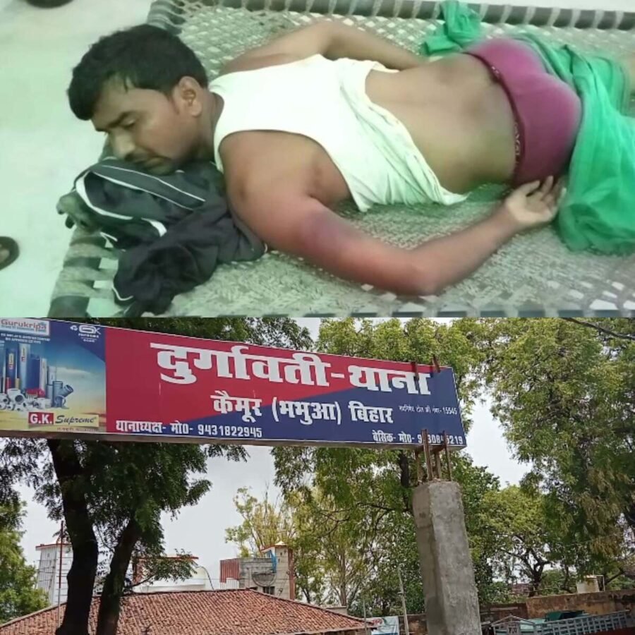 कैमूर: कैमूर में पुलिसिया जुल्म, साईकिल चोरी के शक मे सब्जी व्यवसाई की थाने में तीन दिन बंदकर पुलिस ने की बेरहमी से पीटाई, छुड़ाने गए मुखिया को भी दिया बंद करने की धमकी, थानाध्यक्ष बोले आरोप बेबुनियाद